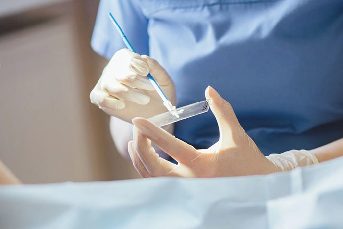 Các phương pháp xét nghiệm ung thư cổ tử cung phổ biến hiện nay hình 2 cac-phuong-phap-xet-nghiem-ung-thu-co-tu-cung-pho-bien-hien-nay-hinh-2.jpg