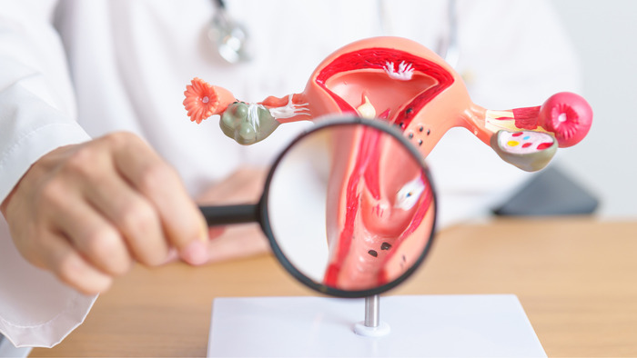 Các phương pháp xét nghiệm ung thư cổ tử cung phổ biến hiện nay hình 3 cac-phuong-phap-xet-nghiem-ung-thu-co-tu-cung-pho-bien-hien-nay-hinh-3.jpg