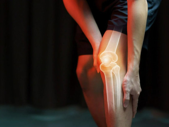 Dấu hiệu ung thư xương ở giai đoạn đầu: Nhận biết để điều trị kịp thời hình 3 dau-hieu-ung-thu-xuong-o-giai-doan-dau-nhan-biet-de-dieu-tri-kip-thoi-hinh-3.jpg