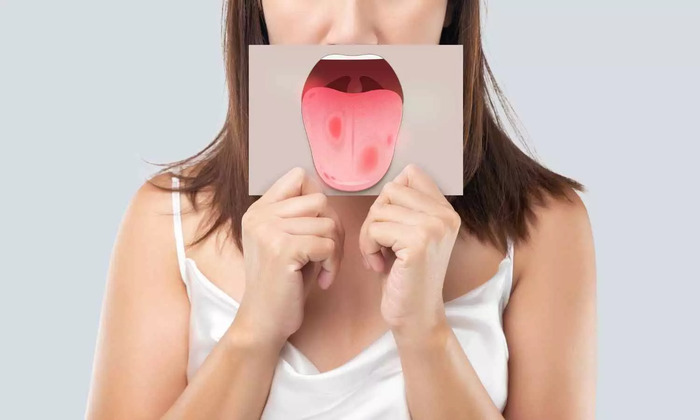 Nhận biết sớm dấu hiệu ung thư lưỡi để điều trị kịp thời hình 1 nhan-biet-som-dau-hieu-ung-thu-luoi-de-dieu-tri-kip-thoi-hinh-1.jpg