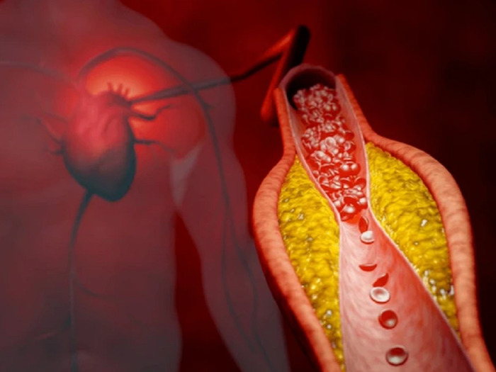 Tức ngực khó thở nên làm gì để tránh nguy hiểm đến tính mạng? hình 3 tuc-nguc-kho-tho-nen-lam-gi-de-tranh-nguy-hiem-den-tinh-mang-hinh-3.jpg