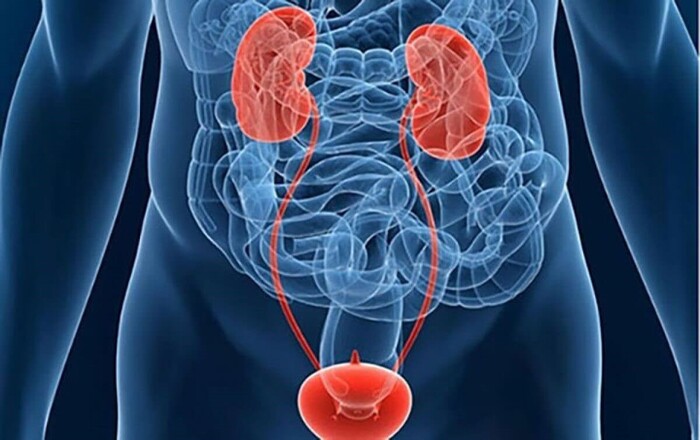 Ung thư bàng quang: Nguyên nhân, triệu chứng và cách điều trị hiệu quả hình 1 ung-thu-bang-quang-nguyen-nhan-trieu-chung-va-cach-dieu-tri-hieu-qua-hinh-1.jpg