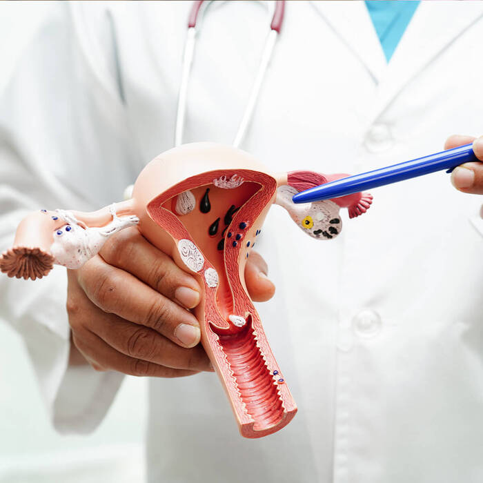 Ung thư cổ tử cung: Nguyên nhân, dấu hiệu và phương pháp điều trị hình 4 ung-thu-co-tu-cung-nguyen-nhan-dau-hieu-va-phuong-phap-dieu-tri-hinh-4.jpg