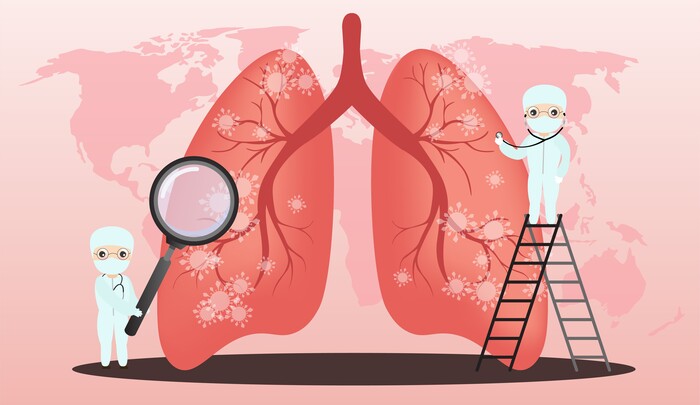 Ung thư phổi: Nguyên nhân, triệu chứng, cách điều trị hiệu quả hiện nay hình 4 ung-thu-phoi-nguyen-nhan-trieu-chung-cach-dieu-tri-hieu-qua-hien-nay-hinh-4.jpg