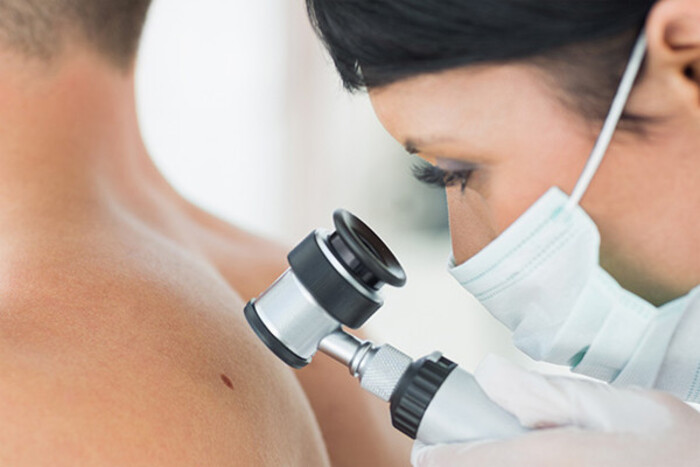 Ung thư sắc tố: Nguyên nhân, triệu chứng và phương pháp phòng tránh số 1 ung-thu-sac-to-nguyen-nhan-trieu-chung-va-phuong-phap-phong-tranh-so-1.jpg