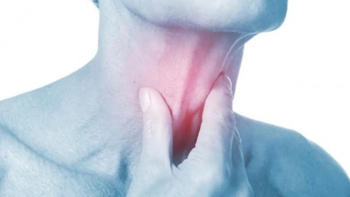 Ung thư vòm họng: Nguyên nhân, triệu chứng và cách điều trị hiệu quả hình 2 ung-thu-vom-hong-nguyen-nhan-trieu-chung-va-cach-dieu-tri-hieu-qua-hinh-2.jpg