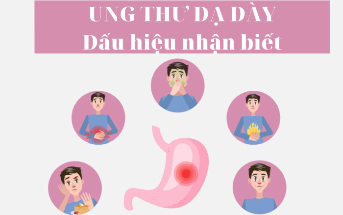 Các dấu hiệu ung thư dạ dày cần đi thăm khám ngay hình 2 cac-dau-hieu-ung-thu-da-day-can-di-tham-kham-ngay-hinh-2.jpg