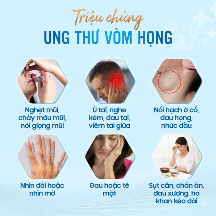 Cảnh báo quan trọng: Dấu hiệu ung thư vòm họng hình 2 canh-bao-quan-trong-dau-hieu-ung-thu-vom-hong-hinh-2.jpg