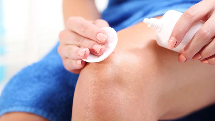 Giải đáp: Có thể trị zona thần kinh tận gốc mà không cần dùng thuốc? hình 2 giai-dap-co-the-tri-zona-than-kinh-tan-goc-ma-khong-can-dung-thuoc-hinh-2.jpg