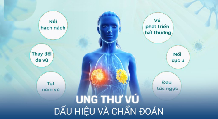 Một số dấu hiệu ung thư vú thường gặp bạn cần biết hình 2 mot-so-dau-hieu-ung-thu-vu-thuong-gap-ban-can-biet-hinh-2.jpg