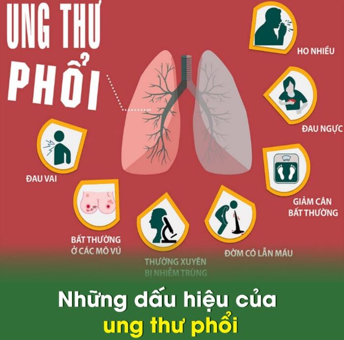Nhận biết các dấu hiệu ung thư phổi để điều trị kịp thời hình 1 nhan-biet-cac-dau-hieu-ung-thu-phoi-de-dieu-tri-kip-thoi-hinh-1.jpg