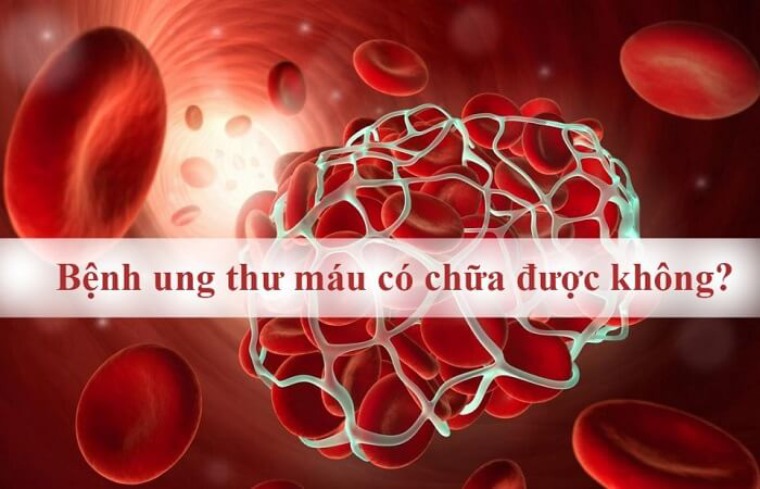 Tìm hiểu bệnh ung thư máu có chữa được không? hình 2 tim-hieu-benh-ung-thu-mau-co-chua-duoc-khong-hinh-2.jpg