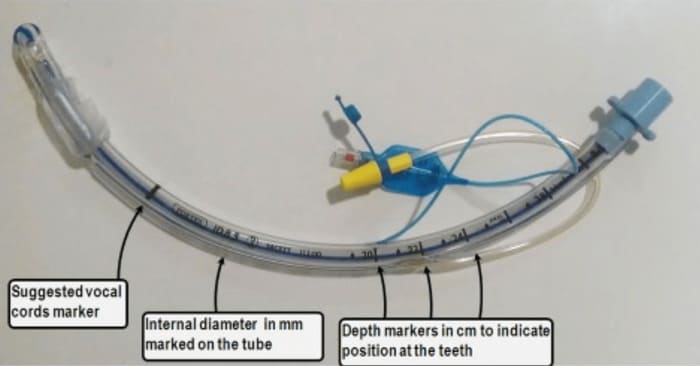 Cách chọn ống nội khí quản trẻ em đúng chuẩn theo khuyến cáo lâm sàng hình 3 cach-chon-ong-noi-khi-quan-tre-em-dung-chuan-theo-khuyen-cao-lam-sang-hinh-3.jpg