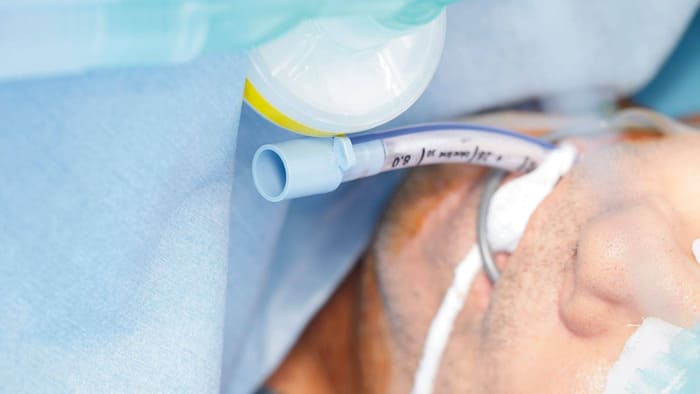 Cách cố định ống nội khí quản: Quy trình, kỹ thuật và lưu ý lâm sàng hình 3 cach-co-dinh-ong-noi-khi-quan-quy-trinh-ky-thuat-va-luu-y-lam-sang-hinh-3.jpg