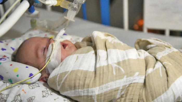 Chỉ định và chống chỉ định khi thực hiện đặt nội khí quản trẻ em hình 3 chi-dinh-va-chong-chi-dinh-khi-thuc-hien-dat-noi-khi-quan-tre-em-hinh-3.jpg