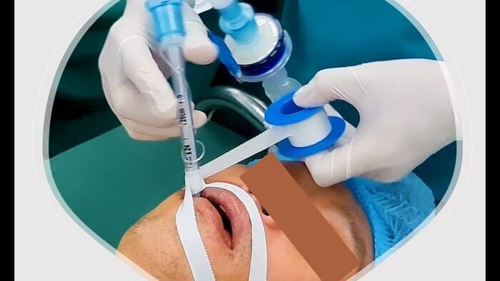 Hướng dẫn từng bước qua video đặt nội khí quản lâm sàng hình 3 huong-dan-tung-buoc-qua-video-dat-noi-khi-quan-lam-sang-hinh-3.jpg