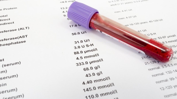 ALT trong xét nghiệm máu là gì? Tất tần tật thông tin bạn cần biết hình 4 alt-trong-xet-nghiem-mau-la-gi-tat-tan-tat-thong-tin-ban-can-biet-hinh-4.jpg