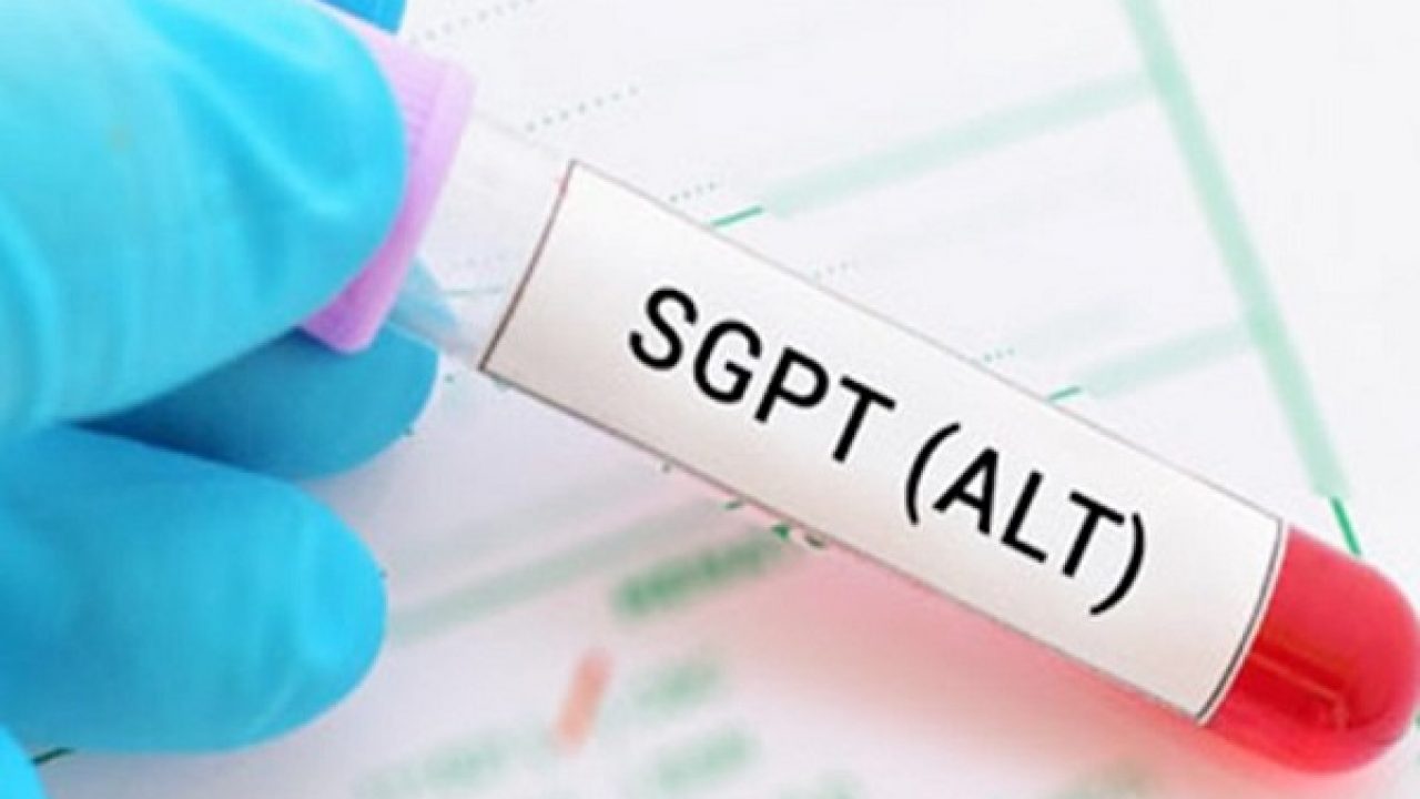 ALT trong xét nghiệm máu là gì? Tất tần tật thông tin bạn cần biết