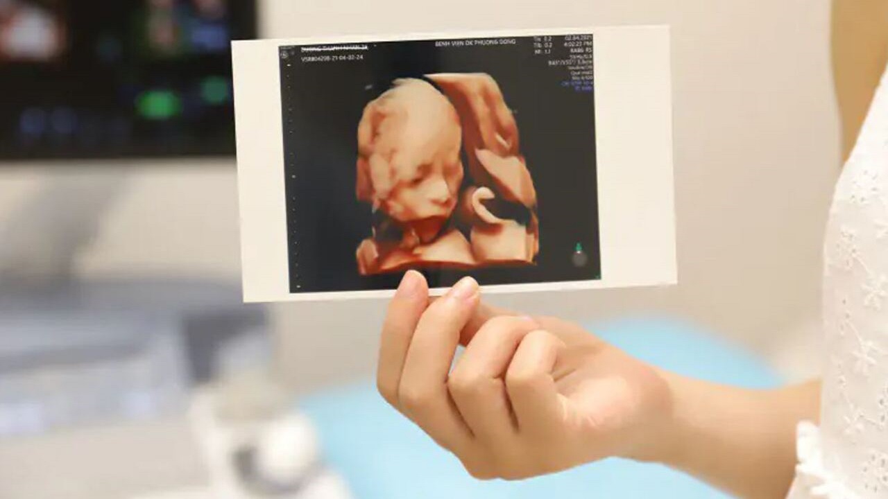 Cách đọc kết quả siêu âm thai không khó như bạn nghĩ