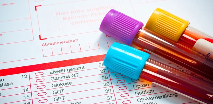 Chỉ số GGT là gì và có liên quan thế nào đến bệnh gan? hình 1 chi-so-ggt-la-gi-va-co-lien-quan-the-nao-den-benh-gan-hinh-1.jpg