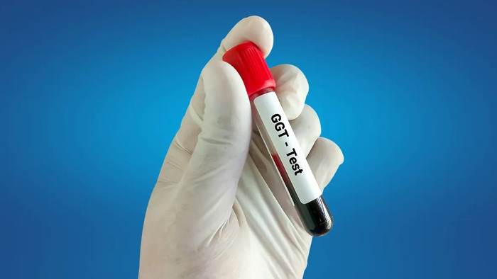 Chỉ số GGT là gì và có liên quan thế nào đến bệnh gan? hình 2 chi-so-ggt-la-gi-va-co-lien-quan-the-nao-den-benh-gan-hinh-2.jpg