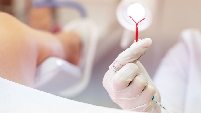 có thai khi đang đặt vòng thì xử lý thế nào 2 co-thai-khi-dang-dat-vong-thi-xu-ly-the-nao-2