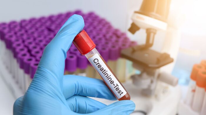 Creatinin là gì và vì sao chỉ số này lại quan trọng với sức khỏe? hình 2 creatinin-la-gi-va-vi-sao-chi-so-nay-lai-quan-trong-voi-suc-khoe-hinh-2.jpg