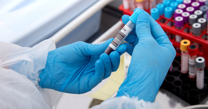 Creatinin là gì và vì sao chỉ số này lại quan trọng với sức khỏe? hình 3 creatinin-la-gi-va-vi-sao-chi-so-nay-lai-quan-trong-voi-suc-khoe-hinh-3.jpeg