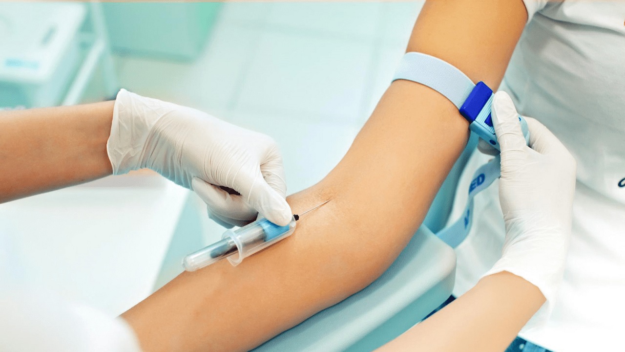 Giải đáp thắc mắc: Xét nghiệm máu lắng để làm gì?