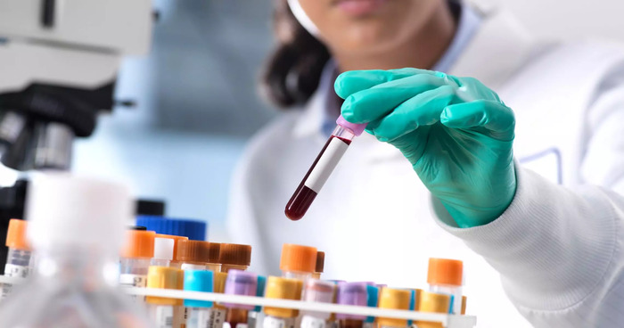 Giải mã AST trong xét nghiệm máu là gì: Vai trò và ý nghĩa lâm sàng hình 4 giai-ma-ast-trong-xet-nghiem-mau-la-gi-vai-tro-va-y-nghia-lam-sang-hinh-4.jpg