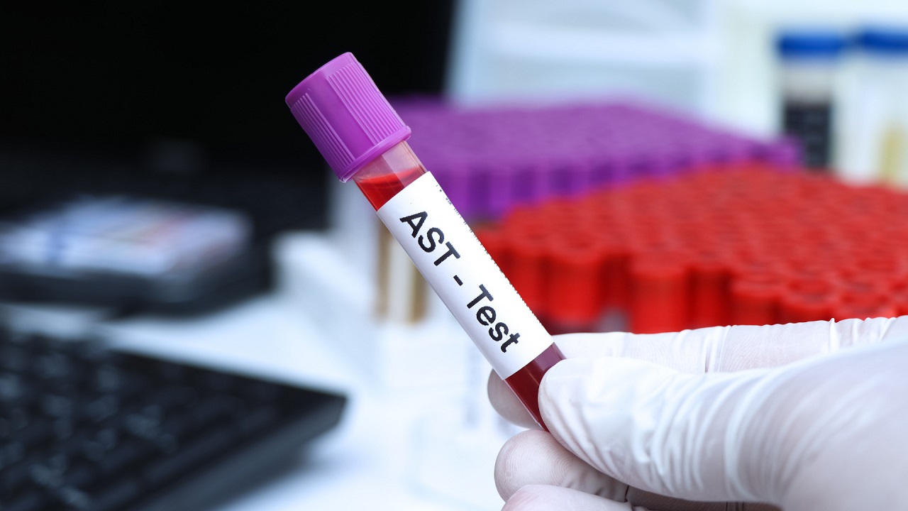 Giải mã AST trong xét nghiệm máu là gì: Vai trò và ý nghĩa lâm sàng