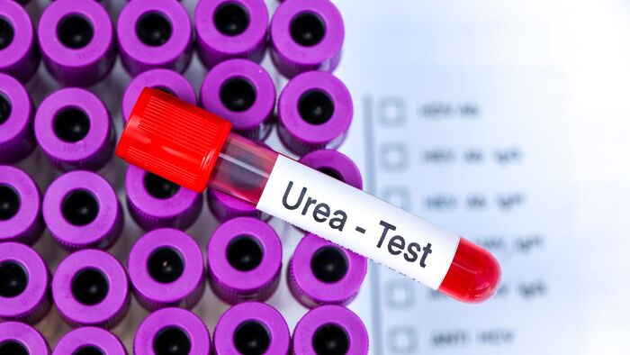 Ure là gì? Vai trò của phương pháp xét nghiệm ure máu hình 4 ure-la-gi-vai-tro-cua-phuong-phap-xet-nghiem-ure-mau-hinh-4.jpg
