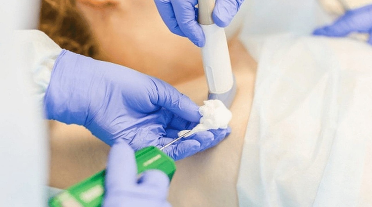 Vì sao nên đặt catheter tĩnh mạch trung tâm cho người bệnh?